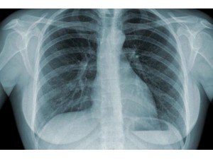 Why do you have to drink barium sulfate before a CT scan? Why do you have to drink barium sulfate before a CT scan?